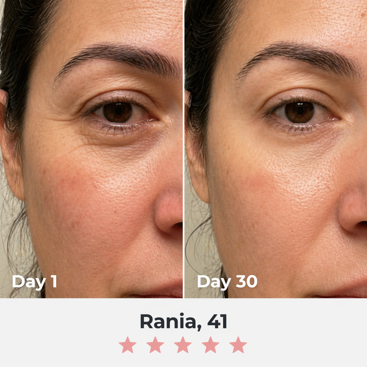 Before and after comparison of a woman's eye area after using The Opalé Sculptor - Facial Sculpter Device with text indicating 'Day 1' and 'Day 30' and a rating.