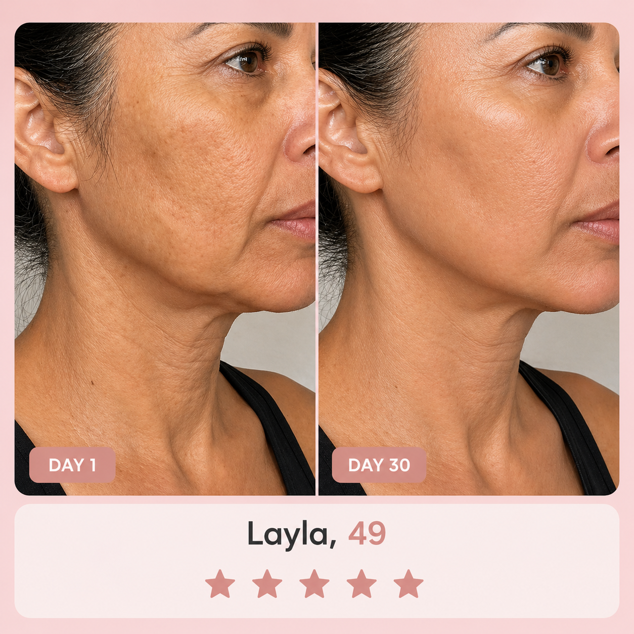 Before and after comparison of a woman's face with visible neck lines after using The Opalé Sculptor - Face Sculpting Device, labeled 'Day 1' and 'Day 30', on a pink background.