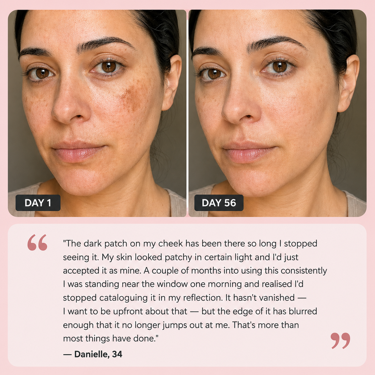 Before and after comparison of a woman's face with improvements after using The Opalé Sculptor - Facial Sculpting Device with text about skin improvement.